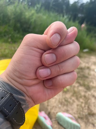 A close-up, low-angle shot captures a hand with fingernails slightly dirty from outdoor activity. The fingers are curled inward, with the thumb resting on the index finger. A tattoo is visible on the wrist, partially obscured by a black watchband with white stitching. In the background, out of focus, is a bright yellow object, green foliage, sandy ground, and a pair of flip-flops. This scene likely represents a moment of rest or pause during an outdoor excursion in Vangaži, Latvia.