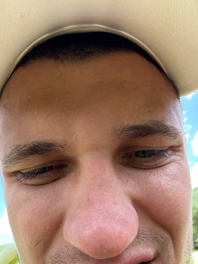 A close-up, low-angle, outdoor shot shows the lower portion of a person's face, specifically their eyes, nose, and mouth, wearing a light-colored baseball cap. The background shows a bright blue sky with white clouds and some distant green foliage, suggesting a sunny day in Vusanje, Montenegro. The individual's skin appears to have a slight sheen, and the texture of their nose and surrounding areas is visible, with some light stubble around the chin and upper lip. The composition is framed by the brim of the cap at the top, obscuring the top of the head and forehead.