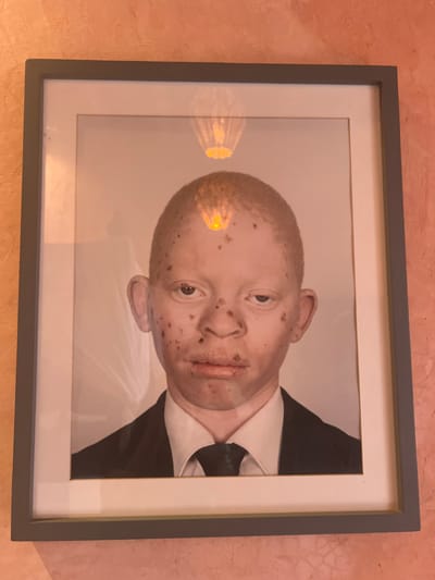 A framed portrait dominates the image. The portrait depicts a person with albinism, wearing a dark suit, white shirt, and dark tie. Light reflects off the glass covering the portrait, creating an orb-like appearance on the left side of the person's head. The frame is dark gray, with a white inner border framing the image. The portrait hangs against a wall that has a textured, pinkish-tan finish.