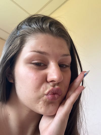 A close-up, selfie-style photograph shows a young woman with brown hair and light skin. She is looking towards the camera with her lips puckered in a kissing pose, and her right hand is raised to her cheek. The woman has light brown eyes and is wearing a small silver stud earring in her left ear. There are several small blemishes on her face. Her fingernails are long and painted with a blue and white design. The background appears to be an indoor setting with a light-colored ceiling with visible structural lines. There is no indication of Prodanovtsi, Bulgaria in the image.