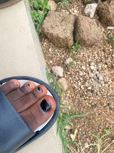 The image is a close-up shot of a person's foot in a black sandal, resting on a light-colored surface. The foot has dark skin and several toes are visible, with some painted black. The background consists of gravelly ground with scattered small rocks and some green vegetation. The scene appears to be outdoors, possibly in a natural or unpaved area. The lighting suggests it could be daytime. The focus is on the foot and sandal, with the background slightly blurred. There is no visible text in the image. The setting, with its gravel and rocks, is consistent with the provided location context of Dumnga, Nigeria.