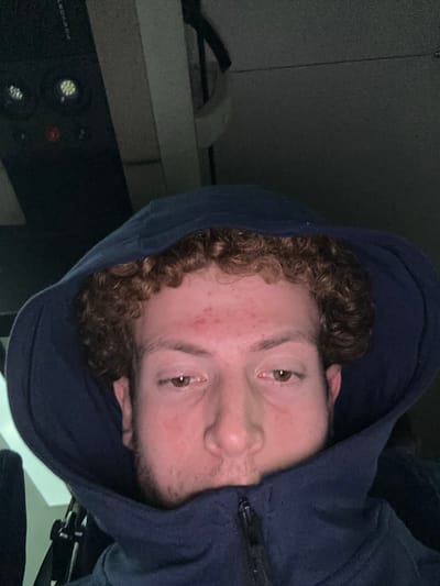 A person with curly brown hair wears a dark blue hoodie, the hood pulled up. They have light skin with some redness on their forehead and cheeks. Their eyes are hazel. The image is rotated, positioning the person's face at an unusual angle. The background appears dark, with some equipment and a desk visible in the periphery, suggesting an indoor setting.