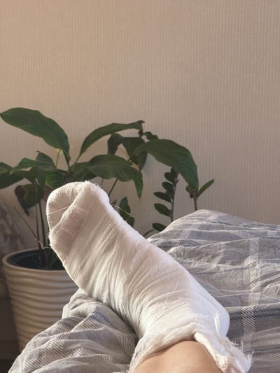 The image shows a cast on a person's leg, covered by a grey and white checkered blanket. A potted plant with large green leaves is visible in the background, along with a wall with vertical textured wallpaper. The scene appears to be indoors, likely a bedroom, given the blanket and the relaxed posture of the leg. The lighting suggests it might be daytime, with sunlight casting shadows. The location of Кирпичного завода № 1, Russia is not discernible from the visual information provided in the image.