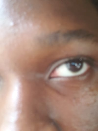 The image is a close-up, blurry shot of a person's eye. The eye is dark brown and appears to be looking slightly upwards. The surrounding skin is a warm brown tone. There are no other discernible subjects, objects, or scene elements. The activity appears to be simply looking. No time of day, weather, location cues, or emotions are evident due to the blurriness and the tight crop. There is no visible text. The provided location context of Alagbede, Nigeria, does not offer any visual cues within the image itself.