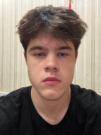 A young male with brown, tousled hair and fair skin is pictured from the chest up. He has blue eyes, a faint stubble on his chin, and a slightly flushed complexion, particularly on his right cheek. He is wearing a plain black t-shirt. The background consists of a wall with vertical, textured stripes. A small red tassel is visible hanging from the top right of the frame. The scene appears to be indoors, likely in a residential setting, and there is no indication of any specific location within Sredneuralsk, Russia.