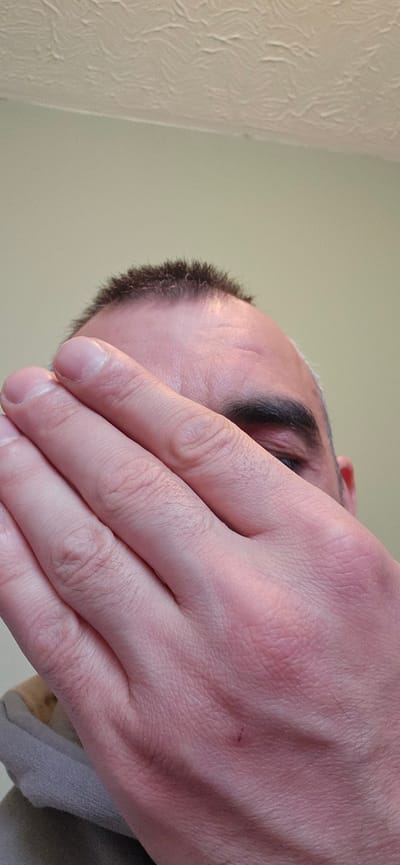 The image presents a close-up, low-angle perspective of a person covering part of their face with their right hand. The hand dominates the foreground, with fingers extending upwards, obscuring the eyes and the bridge of the nose. Only the person's forehead, a dark eyebrow, a sliver of an eye, and the hairline with short, dark hair are visible above the hand. The skin on the hand and visible face appears fair, with discernible texture and fine hairs on the hand. A small, reddish mark is present on the back of the hand. The background is a plain, light-colored surface, likely an indoor wall or ceiling, with a distinctly textured section on the right side, suggesting decorative wallpaper or a stucco finish. The lighting is soft and even, consistent with an indoor environment. The gesture of covering the face conveys a sense of shyness, weariness, privacy, or an effort to shield the eyes from light. No text is visible in the image. The scene is set in Norwich, United Kingdom.