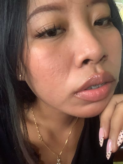 A close-up, low-angle, medium shot captures a young woman's face from the nose down, with her right hand supporting her chin. She has dark hair that falls around her face, and she is wearing a thin gold necklace with a small pendant. Her lips are glossy and a shade of pink, and her teeth are visible behind them, suggesting she might be smiling or speaking. She is also wearing braces. Her fingernails are painted pink with black polka dots in a French manicure style, and one nail is on her chin, while another is visible near her cheek. A small gold stud earring is visible on her left ear. The background is blurred, but it appears to be an indoor setting with some light and possibly furniture. There is no indication of the city of Jajag, Indonesia, or any specific location within it.