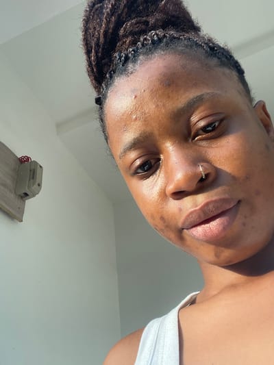 The image is a close-up, angled portrait of an individual, likely a woman, with dark skin and dark hair styled in dreadlocks or braids. The photo is taken from a low, upward-looking perspective, with the subject's head tilted towards their right.
The central focus is the person's face, illuminated by a strong, bright light source, likely natural sunlight, which casts highlights across their forehead, nose, and cheeks. The skin appears dewy or slightly oily, and some minor dark spots or blemishes are visible on the forehead and cheeks.
The person has dark brown eyes that are open and looking downwards, seemingly into the camera lens. A small, gold-toned nose ring, appearing to be a hoop adorned with tiny sparkling elements, is visible on their left nostril. Their lips are full and slightly parted, showing a natural or lightly colored hue. Dark, textured hair, styled in dreadlocks or braids, frames the left side of their face.
On the right side of the frame, a portion of a white tank top or camisole strap is visible, covering the person's shoulder and upper chest.
The background is predominantly a plain, light-colored (white or off-white) wall or ceiling, indicating an indoor setting. In the lower-left portion of the original image (which appears in the lower right when viewed upright), there is an old-fashioned electrical component—possibly a fuse box or switchbox—mounted on a light-colored wooden plank. A coiled red wire is visible near this electrical component.
The overall impression is an intimate, somewhat unconventional portrait, capturing the subject's face with striking lighting and a distinct angle.