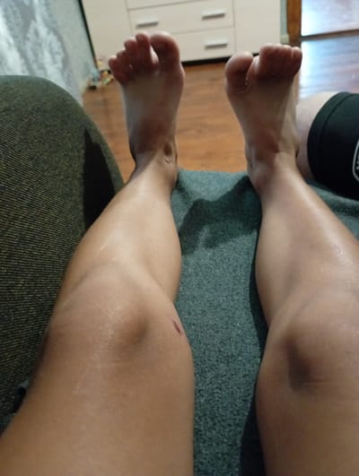 The image shows a close-up view of a person's legs and feet, resting on a dark green textured surface, possibly a sofa or rug. The person's skin is tanned, and there are some visible scars and a small abrasion on the right shin. Their feet are bare, with the toes pointing upwards. The background is blurred but appears to be an indoor setting with wooden flooring and light-colored furniture with drawers, possibly in a room in Verkhniachka, Ukraine. To the right, part of black athletic wear is visible on the upper thigh of the right leg.