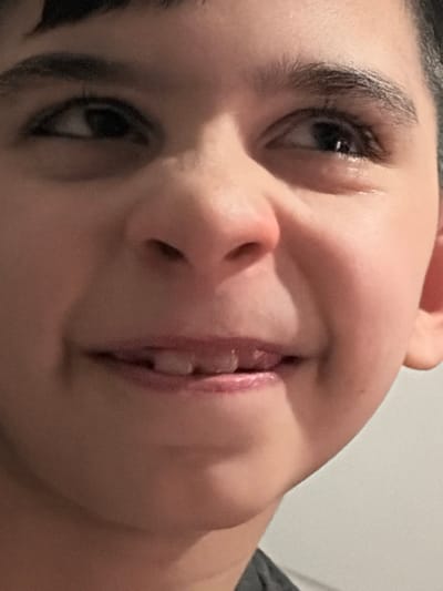 A close-up portrait shows a young individual, likely a child, from approximately the nose line to the lower chin, excluding the forehead. The subject has a light to medium skin tone, dark eyes looking upwards and slightly to the viewer's right, and dark eyebrows. The nose is prominent, and the mouth is slightly open in a subtle, upward curve, revealing two upper central incisors with a visible gap between them. A glistening appears on the lower lash line of the left eye (viewer's right). Dark hair is visible at the top and sides of the frame. A small portion of dark fabric is visible near the bottom edge, suggesting clothing. The background is a uniformly light, out-of-focus surface, indicating an indoor environment. The specific location within the city of Saint-Étienne, France, cannot be determined from the visual information provided in this image.