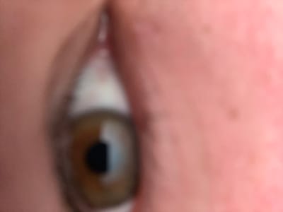 A blurry, extreme close-up captures a hazel eye and surrounding skin. The iris displays a gradient from gold to dark brown. The pupil is black and positioned on the left side of the eye. The whites of the eye are partially visible. The surrounding skin is light-toned with subtle imperfections and moles. The image lacks sharp focus, creating a soft and indistinct effect.