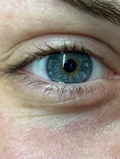 A close-up photograph shows a human eye. The iris is predominantly blue with some yellow/gold near the pupil. The pupil is black and has a rectangular reflection. Eyelashes are visible along the upper and lower eyelids. Skin surrounds the eye with visible fine lines. The image lacks geographic context, so providing a location in Chornomorskoe, Ukraine, is not possible.
