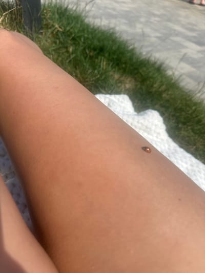 A close-up shot focuses on a person's tanned leg resting on a white towel. A small ladybug is visible on the leg. In the background, green grass and a grey, paved surface are out of focus. The scene appears to be outdoors on a sunny day, possibly in Svitiaz, Ukraine, given the provided context. The overall impression is one of relaxation and enjoyment of nature.