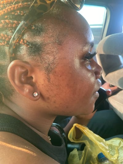 The image displays a close-up profile view of an adult individual, appearing female, with dark brown skin, seated inside what appears to be a vehicle. The subject faces right, with strong sunlight illuminating her left side. She has reddish-brown braided hair extensions, topped by tortoiseshell-patterned sunglasses resting on her head. A small, clear, round stud earring is present in her left earlobe. A delicate gold-colored chain necklace, featuring a small pendant, is visible around her neck. Her facial skin exhibits a sheen consistent with perspiration and some minor surface irregularities. She is wearing a black tank top. In the lower right of the frame, a yellow plastic bag contains a small bottle with a blue cap and an additional dark, cylindrical object. A hand with red-painted fingernails is partially visible in the mid-ground, positioned near the subject's chin. The background consists of light grey/white vehicle upholstery and darker interior paneling. There are no visual elements within the image to confirm the specific geographic location as Tataura, Nigeria.