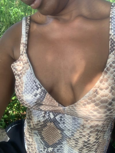 The image captures a close-up of an individual's upper torso and partial face, identified as being in Gidan Jatau, Nigeria. The subject exhibits a dark skin tone, with the chin and lips partially visible at the top edge of the frame. The individual is wearing a v-neck garment with thin shoulder straps, patterned with a design resembling snakeskin, featuring shades of brown, beige, and dark gray. The upper chest, shoulders, and cleavage are exposed. Sunlight casts distinct highlights and shadows across the skin and clothing. The background, largely out of focus, consists of green foliage, indicative of an outdoor, vegetated environment. A fragment of dark-colored fabric is visible at the bottom left, underneath the patterned garment. No specific actions or interactions are discernible.