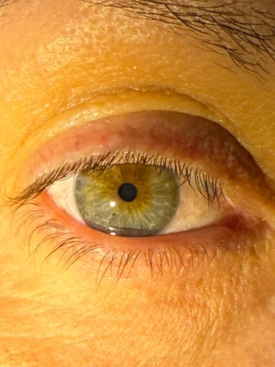 This is a tightly cropped, vertical close-up of a human eye. The central subject is the left eye, which features a striking iris that is predominantly green-blue with a distinct central ring of golden-brown or hazel around the pupil. The pupil itself is black, round, and moderately dilated.
The sclera, or white part of the eye, is visible, appearing largely clear with subtle pinkish tones near the edges, possibly indicating natural vasculature. A small, bright reflection of light is visible on the surface of the eye, suggesting artificial illumination.
Dark, long eyelashes frame both the upper and lower eyelids. In the upper left corner of the image, a portion of a dark eyebrow is visible, indicating the presence of brow hairs. The skin surrounding the eye is light-toned, showing texture, pores, and some fine lines or folds.
There is no specific activity taking place, beyond the eye being open and looking. The image does not provide cues for the time of day, weather, or specific location within Leicester, United Kingdom, other than the context provided. No emotions are explicitly conveyed, and there is no visible text in the image.
