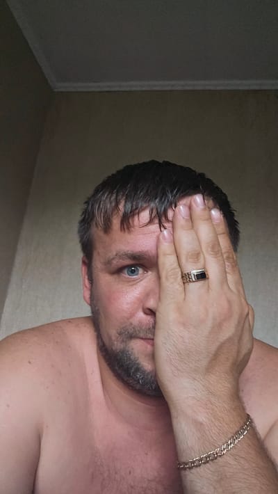 An adult Caucasian male with light skin, short dark hair, and a beard is partially covering his face with his right hand, which is adorned with a gold ring with a black stone and a gold bracelet. He is looking directly at the camera with his left eye, which is blue. His skin appears sunburnt on his shoulders and upper chest. The background consists of a light brown wall and a white ceiling with a decorative molding. The lighting suggests an indoor setting, possibly a bedroom. There is no information about the specific location within the city of Таёжное, Russia.