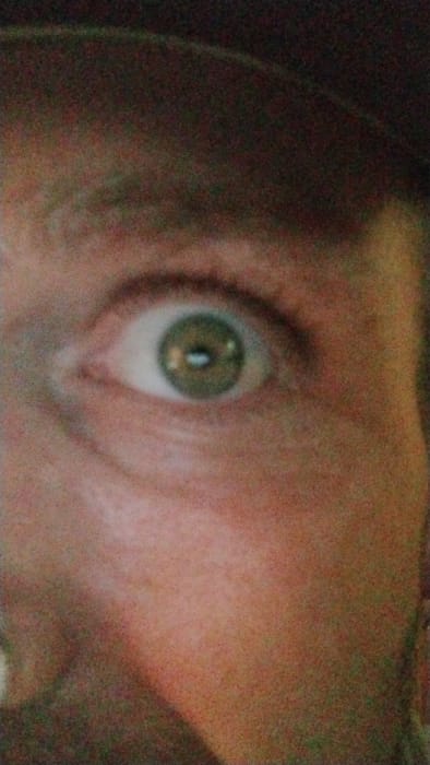 The image is a high-noise, vertical close-up of a single human eye and the immediate surrounding facial skin. The eye features a greenish-hazel iris and a round pupil with a distinct horizontal light reflection. The sclera is visible, appearing white. The skin around the eye, including portions of the eyebrow ridge, cheekbone, and bridge of the nose, shows a fair to medium complexion with visible pores and slight texture. No specific actions or interactions are depicted. The environment beyond the close-up of the face is not discernible. The location in the city of Mariposa, United States, cannot be determined from the image.