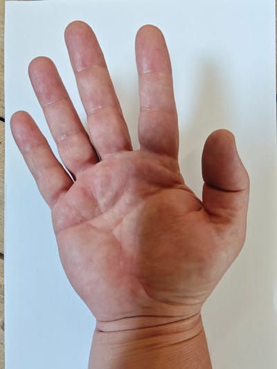 The media file contains a close-up view of the palm and fingers of a person's left hand. The hand is open and facing upwards. The skin tone is fair to medium. The fingers are extended and appear to be resting on a white surface, possibly paper, which occupies the majority of the frame. The background is plain and white. The lighting suggests an indoor setting with diffused light, casting a soft shadow on the white surface to the right of the hand. There are visible creases and lines on the palm and fingers, as well as some slight redness on the knuckles. No text is visible in the image. The image appears to be a static shot, with no activity or event taking place other than the presentation of the hand itself. The overall mood is neutral and observational. The location context of Hofgeismar, Germany, does not offer any specific visual cues within the image itself.