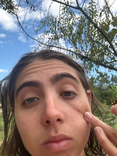 An eye-level close-up, angled, capturing a young woman against a natural backdrop. Her finger touches her cheek near the ear, possibly indicating a point of focus. The shot is from a low angle, allowing a glimpse of the sky and leafy tree branches. The woman's expression is neutral, with focus on her eyes and overall complexion. Natural light illuminates her features, highlighting texture and skin tone.