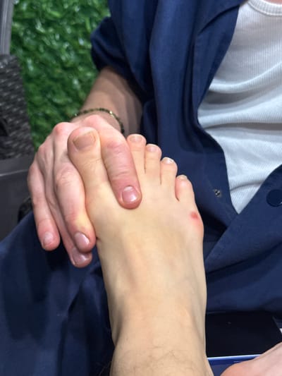 The image shows a close-up of two people interacting. One person's hand is gently holding another person's foot. The foot has a red mark on the side. Both individuals are wearing casual clothing. The background is blurred, showing a hint of greenery and a dark fabric. The scene is indoors, as suggested by the artificial lighting and the fabric textures. The image does not provide any information about the location of Lagodekhi, Georgia.
