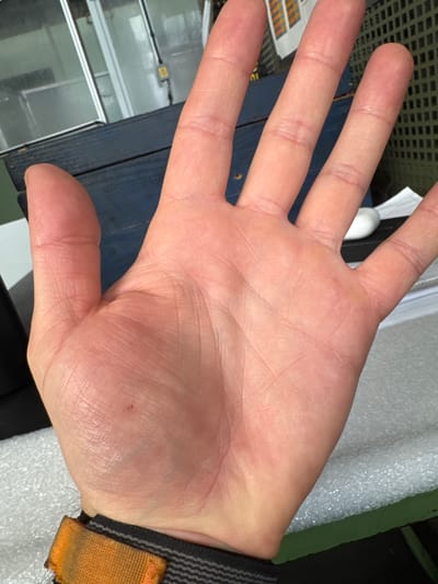 The image shows a close-up view of a person's open palm, with fingers extended. The skin appears lightly tanned and shows natural creases and lines. There is a small, dark red mark, possibly a minor abrasion or speck of dirt, on the center of the palm. A black wristband with an orange fabric loop is visible at the bottom of the frame, around the wrist. The background is blurred, but suggests an indoor environment with some office-like furniture and equipment, including a dark blue cabinet or desk, and a white surface with some paper. The context provided states the image is from Mejaniga, Italy, but the visual information within the image itself does not confirm or deny this location.