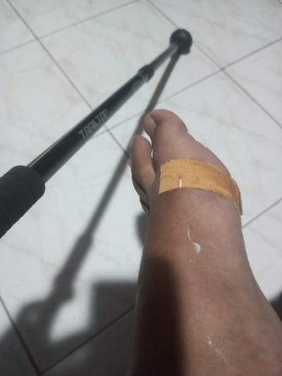 A foot with an adhesive bandage lies on a tiled surface. A small smear of white cream is visible nearby. A black walking stick with a ball-shaped end rests beside the foot, casting a shadow. The brand "TRAILTOP" is visible on the stick. The overall composition suggests an injury or ailment requiring treatment and mobility assistance.