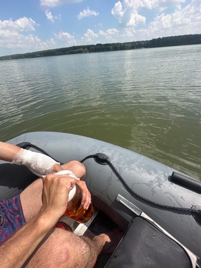 In the city of Pravda, Russia, a person is sitting in an inflatable boat on a body of water. The person's left arm is bandaged. They are holding a glass of beer. The boat is gray with black rope accents. The water is calm and green, reflecting the blue sky with white clouds. In the distance, a tree line borders the water. The overall scene suggests a leisurely outing on a sunny day.
