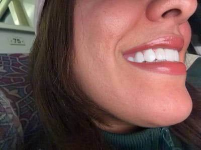 A close-up profile shot features a person's face, highlighting their smile. The individual has fair skin, dark hair, and a prominent nose. Their lips are glossy and plump, revealing bright white teeth. The person wears a dark green garment. A patterned seat and a sign reading "75" are visible in the background. The lighting is soft and indirect.
