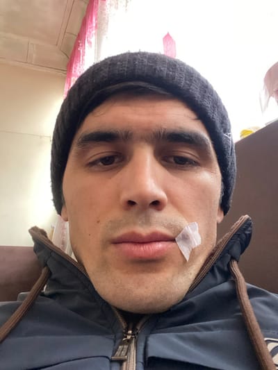 A male individual is depicted in a close-up, head-and-shoulders frontal shot, positioned indoors in Akhtachi, Uzbekistan. He wears a dark, ribbed beanie and a dark blue zip-up jacket with brown drawstrings around the collar. A small, light-colored piece of material, possibly a bandage or tissue, is affixed with tape to the lower right side of his mouth/chin area. The man has dark hair, prominent dark eyebrows, brown eyes, and appears to have short facial stubble. He looks directly forward with a neutral expression. The background is brightly illuminated, indicating a window or light source behind him, with translucent pink fabric elements visible on the right. A light-colored wall or ceiling structure is present to the upper left. A brown object, possibly furniture, is partially visible to the left of his jacket.