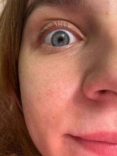 The image is a close-up shot of a person's face, focusing on their eye, nose, and mouth. The person has fair skin with visible pores and a few small blemishes. Their eye is open, revealing a blue iris with a reflection in the pupil. The person's lips are slightly parted and appear to have a pinkish hue. The background is blurred, but hints of brown hair are visible on the left side of the frame. The image does not provide any information about the city of Vyksa, Russia, or any specific location.