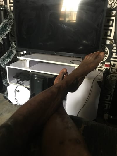 In an indoor setting in Oba-Ile, Nigeria, a close-up, low-angle shot captures the bare legs and feet of an individual, crossed at the ankles, resting in the foreground on what appears to be an upholstered surface. The subject's dark-toned skin exhibits visible scarring or marks on the shins. In the background, a large, dark-screened LG television is positioned on a white, multi-tiered stand. The television screen reflects a bright window with horizontal panes. On the lower shelf of the white stand, a black electronic device, resembling a CPU tower, is visible alongside a black bag and several cables. The wall behind the television and stand features a black and white geometric patterned wallpaper. To the left of the television, a vertical element decorated with a green and white tinsel-like garland is present.