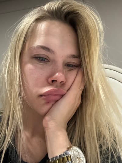 A young woman with fair skin, blonde hair, and blue eyes poses. Her face, tilted to the side, rests on her hand, showcasing a watch on her wrist. She wears a ring and is positioned indoors against a backdrop of a white, textured headboard. Her lips are slightly puckered.