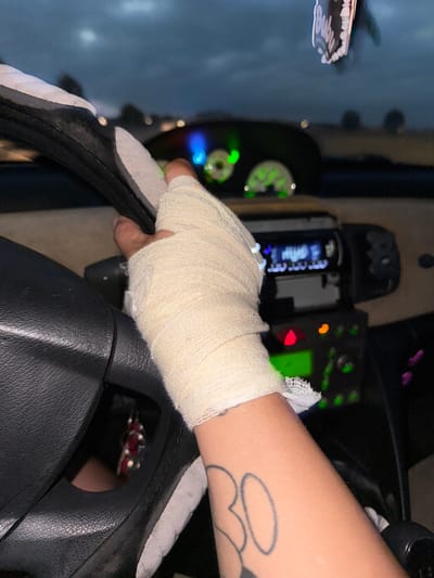 The image shows a close-up of a person's bandaged hand gripping a car's steering wheel. The setting appears to be inside a vehicle at dusk or night, with the car's dashboard lights illuminated. The sky outside is dark and cloudy. On the dashboard, a car radio is visible. The person's arm, partially visible, has a tattoo. The overall scene is dimly lit, with the focus on the hand and steering wheel. There is no identifiable information in the image that would suggest a location in the city of Villa Pasquali, Italy.