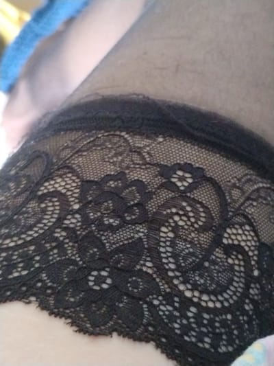 The image is a close-up, overhead shot of a person's upper thigh, with a black lace stocking visible. The stocking has a floral pattern and a scalloped edge. The skin tone of the thigh is light, and some fine hairs are visible. A blurred blue object is present in the upper left corner of the image. The image is not geographically specific to Sofiysk, Russia, or any other city.
