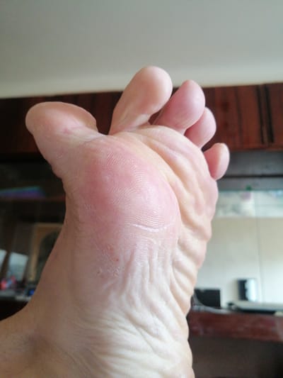 A close-up, high-angle shot showcases the sole of a person's foot, revealing pronounced skin texture and calluses. The foot is light-skinned with visible lines and ridges, particularly on the heel and across the ball of the foot. The toes, particularly the big toe and the second toe, are slightly separated. A small, red dot, possibly a blemish or minor injury, is visible on the skin near the base of the toes. The background is blurred, showing a dimly lit interior with wooden furniture, likely a shelf or cabinet, and what appears to be a wall with a horizontal line. No specific urban features of Stroitel, Russia, are discernible.