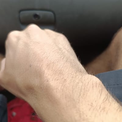 The image shows a close-up of a person's forearm with fine hairs. The skin is light-colored. In the background, there appears to be a dark gray surface with a raised, rounded object with a circular indentation. To the right and bottom, there is a dark blue textured fabric. In the lower left corner, a blurred red object is visible. The image is a close-up and does not provide enough context to determine the location within the city of Lyubimets, Bulgaria.