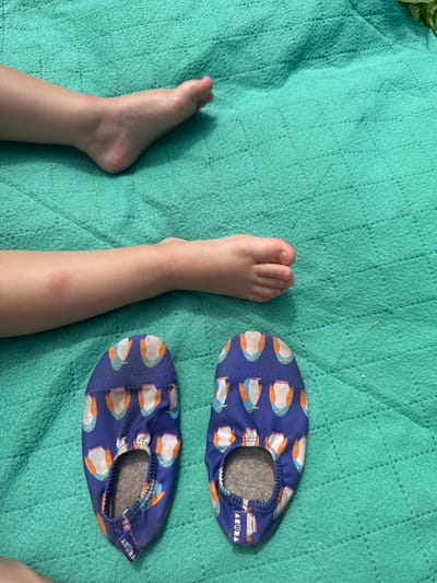 In an outdoor scene on a teal quilted blanket, two child's feet are visible, with two blue water shoes adorned with a penguin pattern lying on the blanket in front of them. The child's legs and feet are slightly red, suggesting possible irritation or sunburn. The setting is likely a recreational area within Дзержинец-83 Снт, Russia, given the mention of the location.