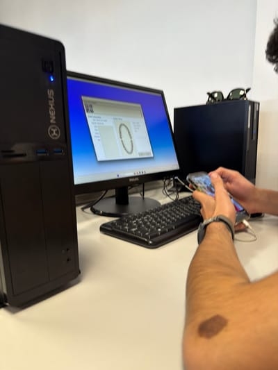 The scene is an office or laboratory environment located in Gandra, Portugal. A light-colored desk occupies the foreground against a plain white wall. On the desk, a black NEXUS computer tower with an illuminated blue power indicator is positioned on the left. A black Philips monitor displays a dental software interface featuring a dental arch diagram, labeled sections like "Nicho Maxilar" and "Dados do Paciente," against a blue background. A black QWERTY keyboard is centered in front of the monitor. To the right of the monitor stands a second black computer tower, upon which two pairs of dark-lensed sunglasses rest. In the immediate foreground, the right arm and hands of an individual are visible. The individual has dark, curly hair partially visible on the upper right. A dark-colored wristwatch is on the person's left wrist. The hands are holding an illuminated smartphone, encased in a clear cover, which is connected to a white charging cable. An irregular, dark pigmented lesion is present on the visible upper right arm.