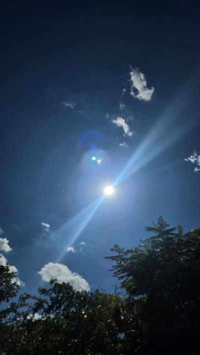 The image is a vertical, outdoor, low-angle shot looking up at the sky. The sun is the prominent feature, positioned slightly to the right of the center, emitting bright rays and lens flare in shades of blue and white. Scattered white clouds are visible against a deep blue sky. In the foreground, the tops of dark green trees are silhouetted against the sky. The image does not provide any information about the city of Liliak, Bulgaria.