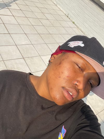 The image is a close-up, high-angle, outdoor selfie taken on a sunny day. The subject, a person with dark skin and acne on their face, is wearing a black t-shirt and a black baseball cap with a red brim and a white embroidered logo. They have a nose ring and a cross earring. The background is a tiled surface with diagonal lines, suggestive of a patio or walkway. The lighting creates strong shadows, indicating the sun is high in the sky. The image does not contain any discernible landmarks or indicators that would place it specifically within Randburg, South Africa.