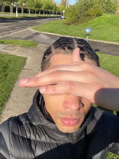 The image depicts a close-up, first-person view of an individual in an outdoor setting within Montigny-le-Bretonneux, France, likely on a clear, sunny day. The subject is a person of color, presenting as male, with dark, braided hair styled in cornrows with a visible central part. They are wearing a black quilted puffer jacket, visible from the upper chest to the shoulders. Their right hand is raised, palm partially facing the camera, with fingers slightly splayed, covering the upper half of their face (eyes and forehead) to shield from direct sunlight. The lower part of the face is visible, showing a nose with freckles/pores and pink lips. Strong sunlight illuminates the scene from the left, casting a distinct shadow from the hand onto the subject's face and jacket.
The background reveals a paved pathway or sidewalk in the immediate foreground, transitioning to green grassy areas with scattered small yellow flowers. Beyond this, an asphalt road or wider pathway curves through the midground. To the right, a silver spherical object on a light-colored pole stands within a grassy area. Further back, a gently sloping green mound with dense bushes is visible. In the distance, a line of uniformly spaced, slender trees with light trunks and green foliage forms a visual barrier, behind which a small blue car is partially visible near a triangular road sign. The overall environment suggests a well-maintained park or residential green space with pedestrian infrastructure.