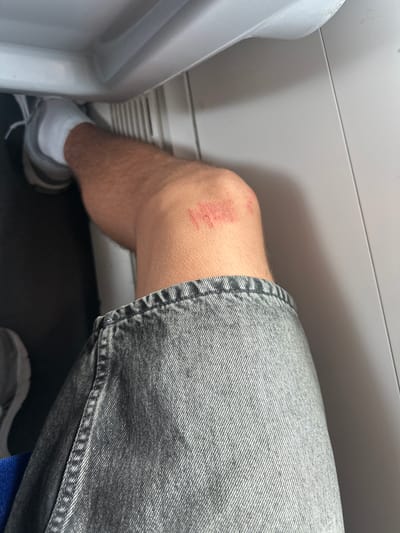 The image shows a close-up view of a person's left knee and part of their thigh, along with a portion of their leg below the knee and their foot. The knee has a fresh red scrape with visible abrasions and what appears to be dried blood. The person is wearing denim shorts, white socks, and athletic shoes. The background suggests an indoor setting with a light gray, textured wall and a darker gray floor. To the left of the frame, a portion of a white plastic object is visible, possibly a seat or piece of furniture. The lighting appears to be artificial, and there are no strong shadows to indicate a specific time of day. The image composition focuses on the injury on the knee, hinting at an accident or fall. No text is visible in the image. The location context is Salses-le-Château, France, but there are no specific visual cues within the image to confirm this location.