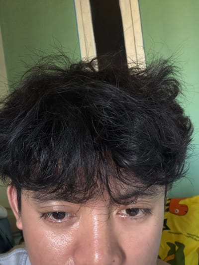 The image shows a close-up, head-on view of a person's face and messy black hair. The person appears to be young, with fair skin that is shiny, possibly from sweat or oil. Their eyes are open and looking downwards. The background is a plain, light green wall, with a thin vertical stripe of white and black to the right of the person's head. A yellow pillow with an orange bird-like cartoon character is visible on the far right. The image does not provide any specific clues to its location within Denasri Kulon, Indonesia.