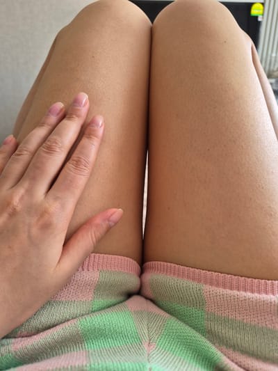The image shows a close-up view of a person's thighs, with a hand resting on the left thigh. The skin appears fair and slightly textured. The person is wearing pajama bottoms with a plaid pattern of pink and green. The background is a light-colored wall. The image does not provide any information that would allow for determining the location in the city of Bilohorodka, Ukraine.