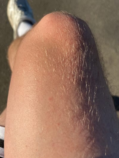 The image is a close-up, low-angle shot of a person's knee and upper shin, likely taken outdoors in Kalynivka, Ukraine. The skin is fair and appears to have light hair, particularly on the shin, which is illuminated by sunlight, creating a shimmering effect. The texture of the skin, with visible pores and some minor redness, is apparent. In the upper left corner, the toe and sole of a white sneaker with a grey accent are visible, suggesting the person is wearing athletic footwear. A portion of a white sock is also visible. The background is a muted, textured surface, possibly asphalt or concrete, indicative of an urban or park environment.