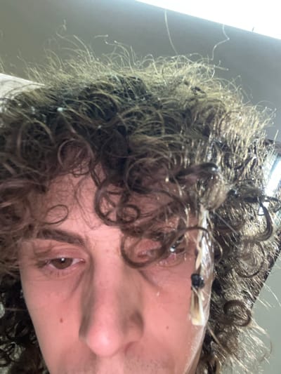 Close-up, rotated image of a person's face and hair. The person has curly, dark brown hair, with some strands appearing wet or styled with product. The individual's skin is fair with some redness and minor blemishes visible. Only one eye is visible, it's brown. A hair clip is partially visible in the upper right of the frame. The background is out of focus and appears to be an indoor setting with some light sources visible. There is no indication of Bahía Blanca, Argentina, or any specific location information.