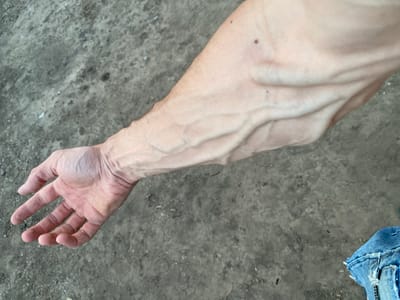 This is a close-up, high-angle shot of a person's arm and hand against a grey, granular background. The skin on the arm is pale with prominent blue veins visible due to the lighting and possibly low body fat. The hand is open, fingers slightly curled, and also shows visible veins. The background appears to be a mixture of dirt, small stones, and possibly some debris, suggesting an outdoor, possibly urban or rural, environment. There is a small mole visible on the upper arm. The bottom right corner of the image shows a small portion of blue denim fabric, possibly from clothing. The lighting casts shadows, highlighting the texture of the skin and the ground. The image does not contain any information about the city of Cairaclia, Moldova, or any specific location.