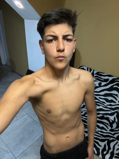 A shirtless young man with short dark hair is shown from the chest up. He is wearing dark shorts. He is indoors, with a zebra-striped fabric behind him. The background also includes a wall that is a light, neutral color. The floor appears to be tiled. The location is not discernible in this image.