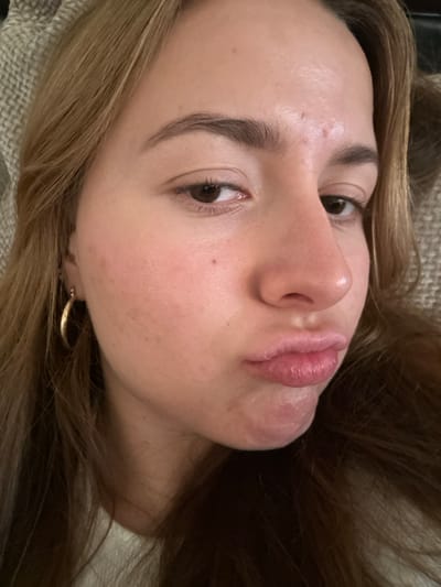 A close-up, slightly tilted shot features a young woman's face. She has light skin, brown eyes, and medium-length brown hair. Her lips are pursed in a slight pout. Subtle skin imperfections, like freckles and minor blemishes, are visible. A gold hoop earring is seen on one ear. The background shows a textured surface, likely fabric, and additional strands of her hair. The image has a natural, unfiltered aesthetic.